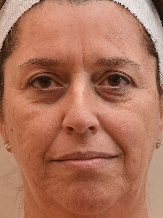 Dus ik keek voordat ik Eudalie Cream gebruikte