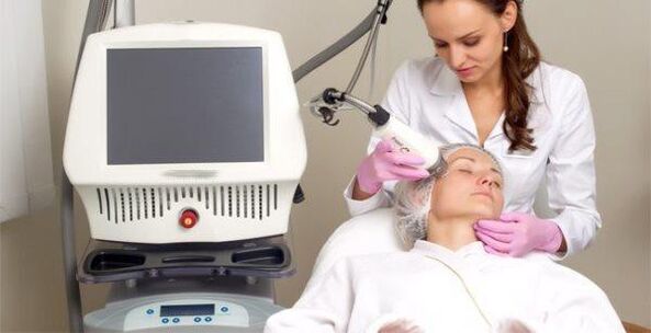 Het uitvoeren van de procedure