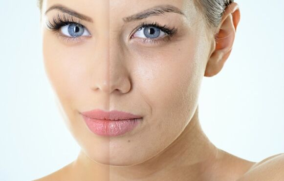 Indicaties voor fractionele verjonging